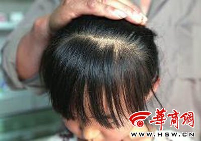 　8歲的嘟嘟在爺爺懷中顯得特別害怕，3個月前被老師揪掉的頭發(fā)至今沒有長出 本報記者 趙釗 攝