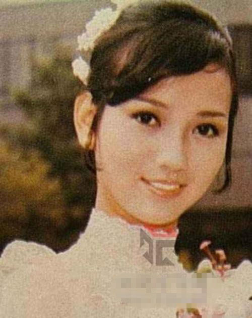 58歲趙雅芝長腿驚現(xiàn)長疤痕 偷情被暴打內幕遭曝光