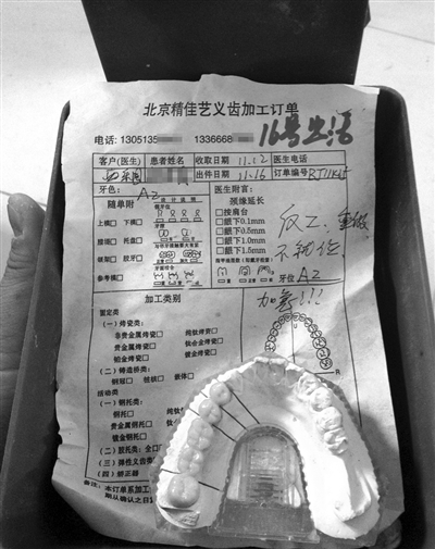 精佳藝義齒加工訂單顯示“反（返）工、重做”等字樣，一名骨干業(yè)務(wù)員說，該廠產(chǎn)品返工率占兩成。