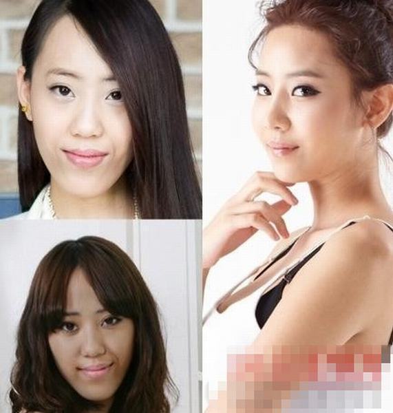 韓國《LET 美人2》整容節(jié)目前后對(duì)比驚人